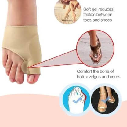 Toe_Bunion_Corrector_Gallery_Img4-min